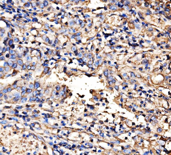 HECTD1 Rabbit Polyclonal Antibody