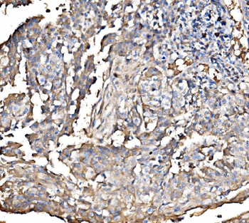 HMGCS2 Antibody
