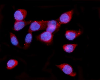 ORP150/HYOU1 Rabbit Polyclonal Antibody