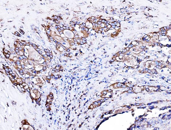 ORP150/HYOU1 Rabbit Polyclonal Antibody