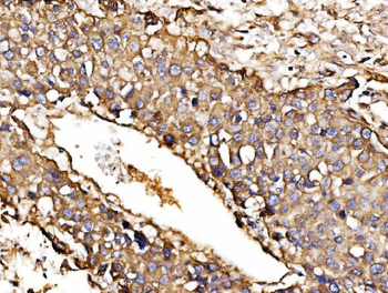 ORP150/HYOU1 Rabbit Polyclonal Antibody