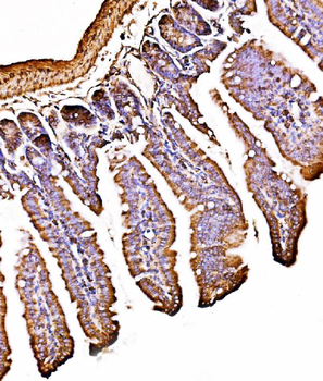 ORP150/HYOU1 Rabbit Polyclonal Antibody