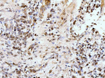 IFI16 Rabbit Polyclonal Antibody