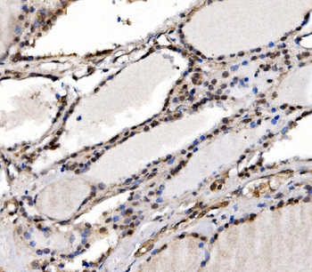 IFI16 Rabbit Polyclonal Antibody