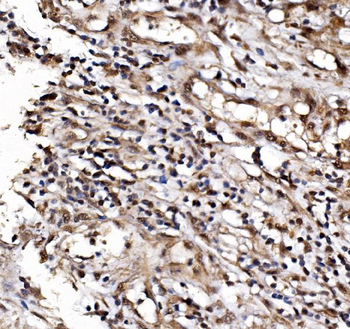 IFI16 Rabbit Polyclonal Antibody