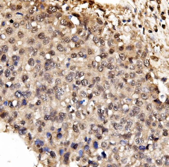 IFI16 Rabbit Polyclonal Antibody