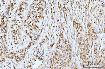 IFI16 Rabbit Polyclonal Antibody