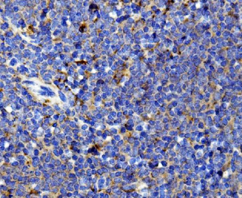 Il13 Rabbit Polyclonal Antibody
