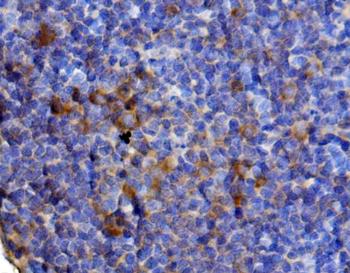 Il13 Rabbit Polyclonal Antibody