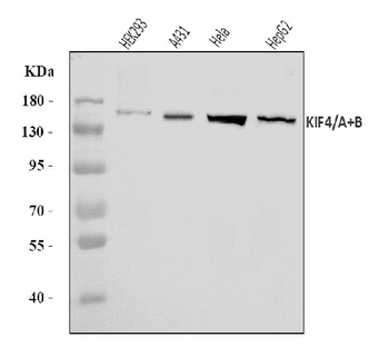 KIF4A/4B Rabbit Polyclonal Antibody