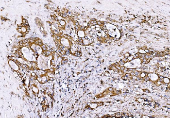 GPR54/KISS1R Rabbit Polyclonal Antibody