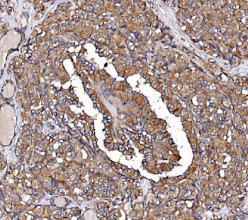 GPR54/KISS1R Rabbit Polyclonal Antibody