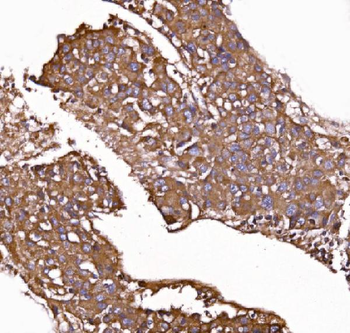 GPR54/KISS1R Rabbit Polyclonal Antibody