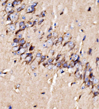 GPR54/KISS1R Rabbit Polyclonal Antibody