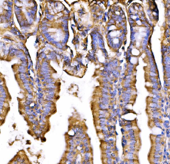GPR54/KISS1R Rabbit Polyclonal Antibody