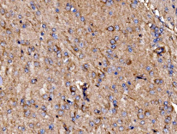 GPR54/KISS1R Rabbit Polyclonal Antibody