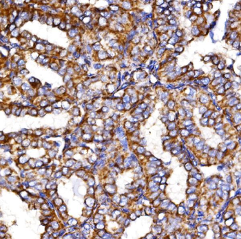 MDH2 Antibody
