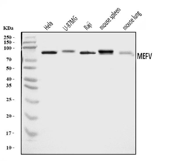 Pyrin/MEFV Rabbit Polyclonal Antibody