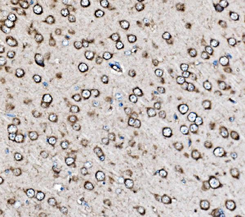 MRPS25 Rabbit Polyclonal Antibody