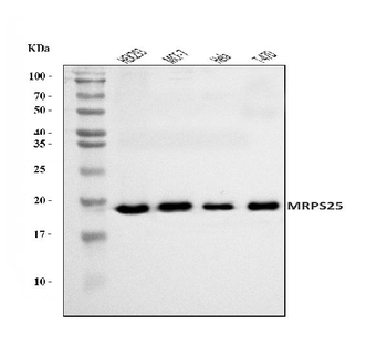 MRPS25 Rabbit Polyclonal Antibody