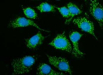 MRPS25 Rabbit Polyclonal Antibody