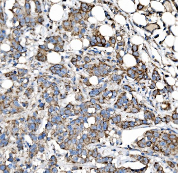 MRPS25 Rabbit Polyclonal Antibody