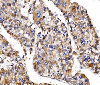 MRPS25 Rabbit Polyclonal Antibody