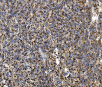 MRPS25 Rabbit Polyclonal Antibody