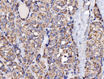MRPS25 Rabbit Polyclonal Antibody