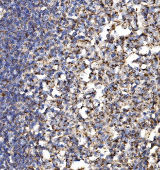 MRPS25 Rabbit Polyclonal Antibody