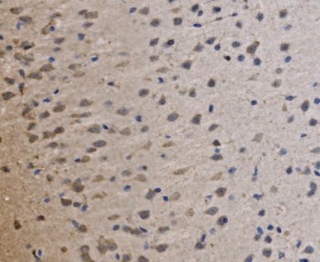 MRPS25 Rabbit Polyclonal Antibody
