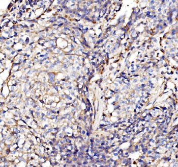 NDUFAF1 Antibody
