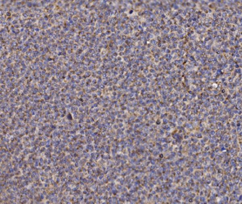 NDUFAF1 Antibody