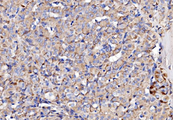 NDUFAF1 Antibody