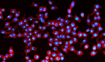 NOL10 Rabbit Polyclonal Antibody