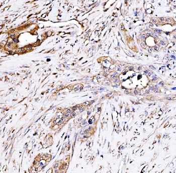 PAK2 Rabbit Polyclonal Antibody