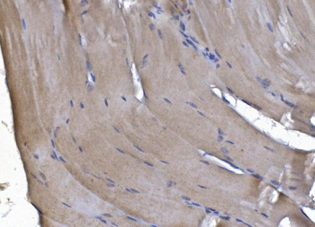 PAK2 Rabbit Polyclonal Antibody