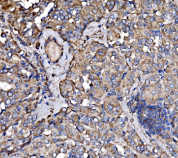 PAK3 Rabbit Polyclonal Antibody