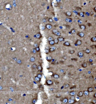 PAK3 Rabbit Polyclonal Antibody