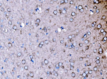 PAK3 Rabbit Polyclonal Antibody