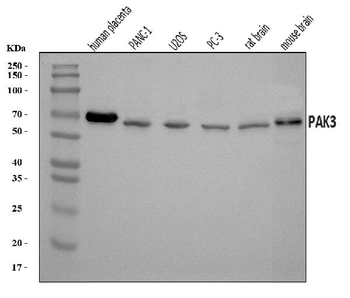 PAK3 Rabbit Polyclonal Antibody