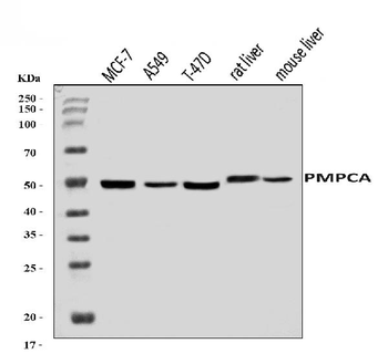 PMPCA/INPP5 Rabbit Polyclonal Antibody