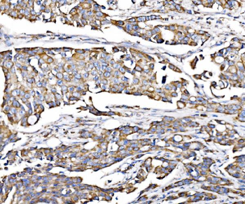 PMPCA/INPP5 Rabbit Polyclonal Antibody