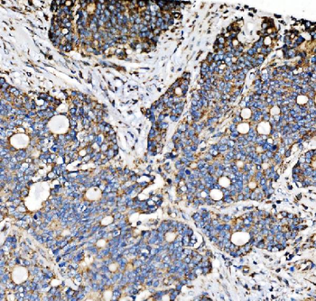 PMPCA/INPP5 Rabbit Polyclonal Antibody