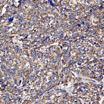 PMPCA/INPP5 Rabbit Polyclonal Antibody