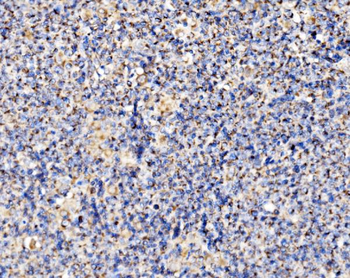 PMPCA/INPP5 Rabbit Polyclonal Antibody
