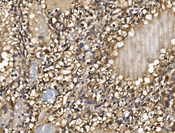 PMPCA/INPP5 Rabbit Polyclonal Antibody