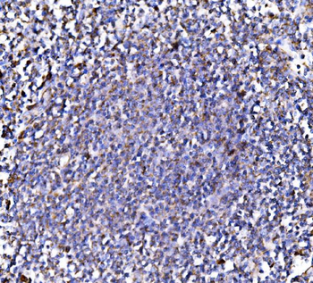 PMPCA/INPP5 Rabbit Polyclonal Antibody
