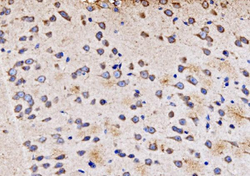 PMPCA/INPP5 Rabbit Polyclonal Antibody