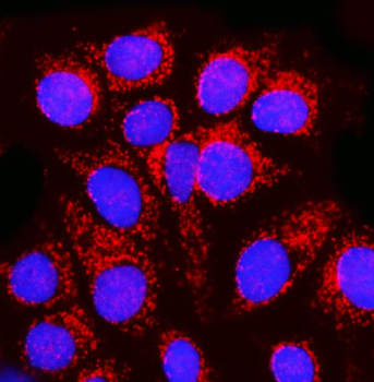 MPPB/PMPCB Rabbit Polyclonal Antibody